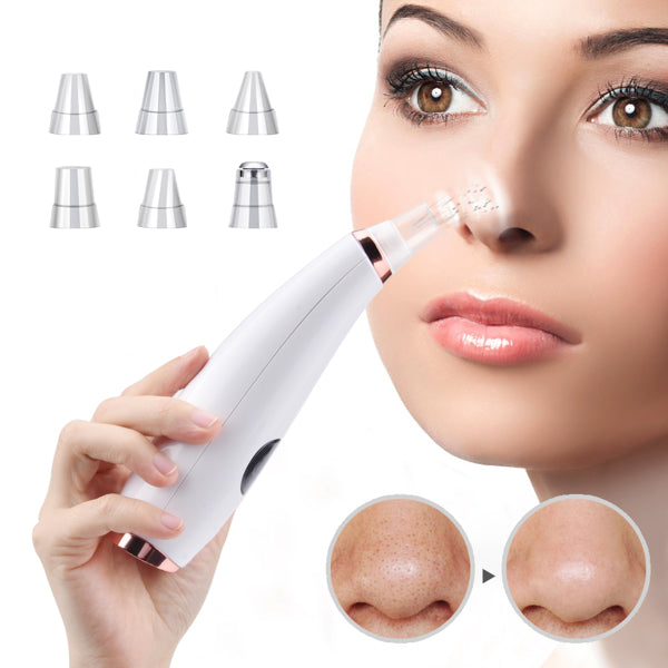 Facial Pore Cleaner – Vacuum Blackhead Remover with 5 Interchangeable Heads