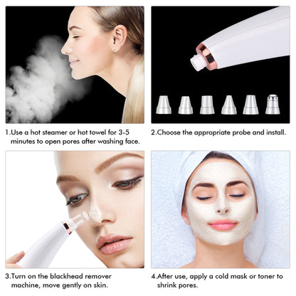 Facial Pore Cleaner – Vacuum Blackhead Remover with 5 Interchangeable Heads